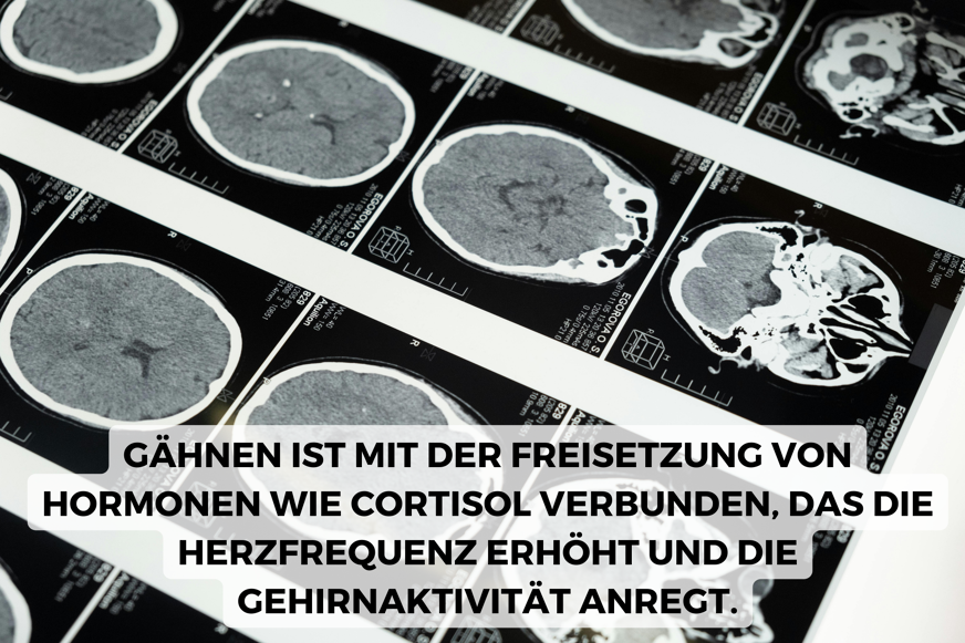 gaehnen ist mit kortisol verlinkt